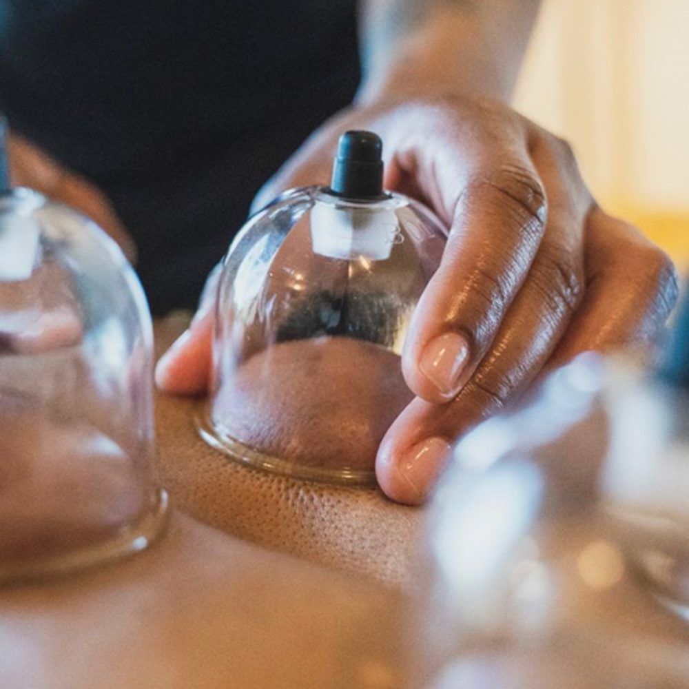 Cupping.jpg